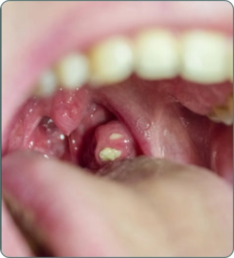 Ear nose throat illustration