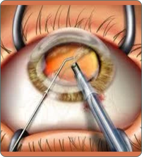 Ophthalmology treatments and procedures imagery