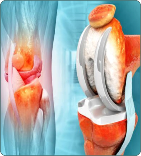 Orthopedic treatments and procedures imagery