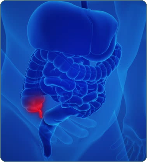 General surgery and laparoscopy illustration