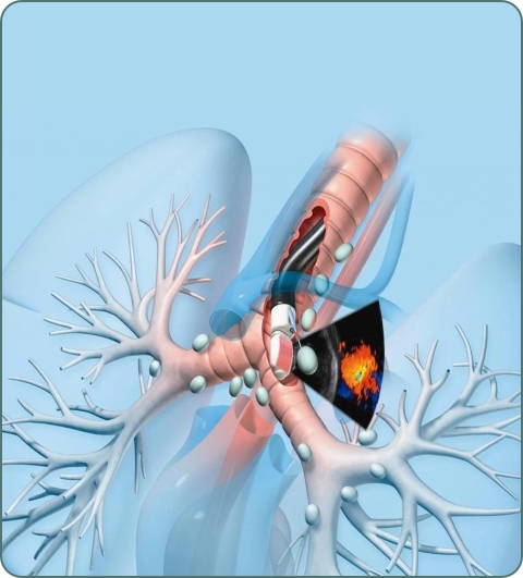 Pulmonology treatments and procedures imagery