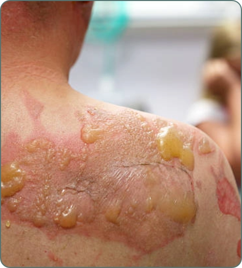 Plastic surgery and reconstruction illustration