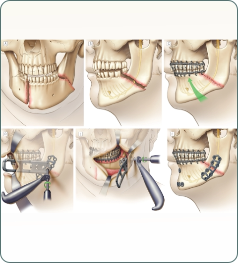 Plastic surgery diagnostic investigations imagery