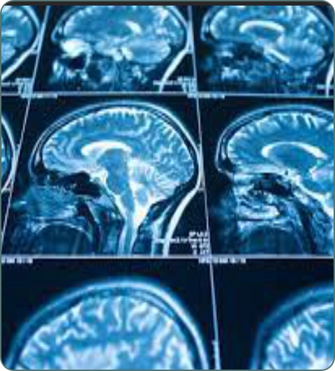 Psychiatry diagnostic investigations imagery