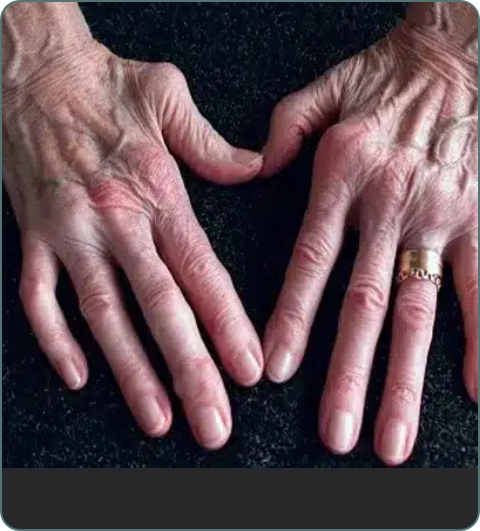 Rheumatology and joint care illustration