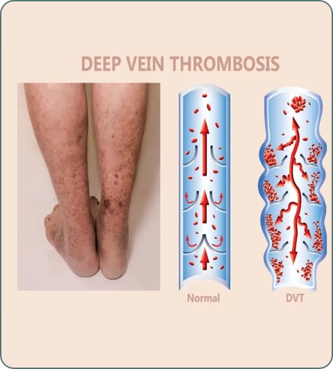 Interventional radiology illustration