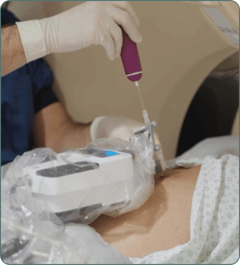 Interventional radiology diagnostic investigations imagery