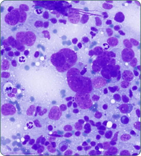 Surgical oncology diagnostic investigations imagery