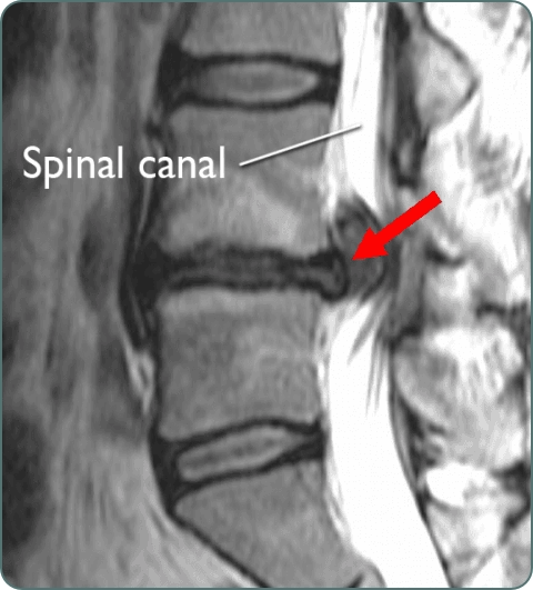 Neuro spine surgery diagnostic investigations imagery
